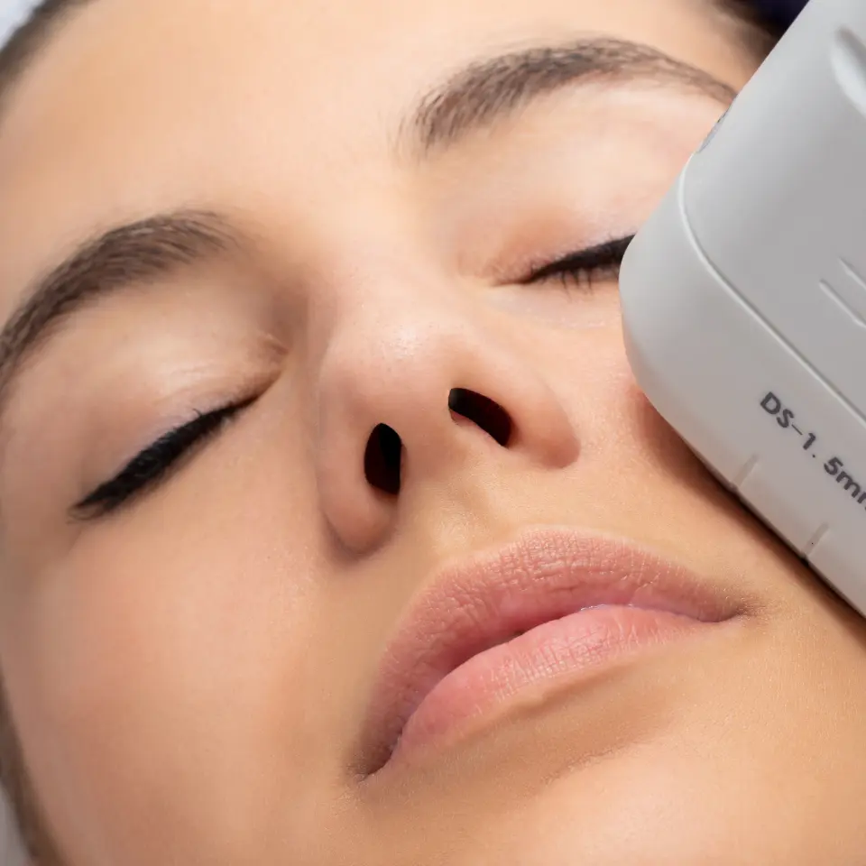 Hifu Granada: Tratamiento rejuvenecedor facial | Cocoon Imagen